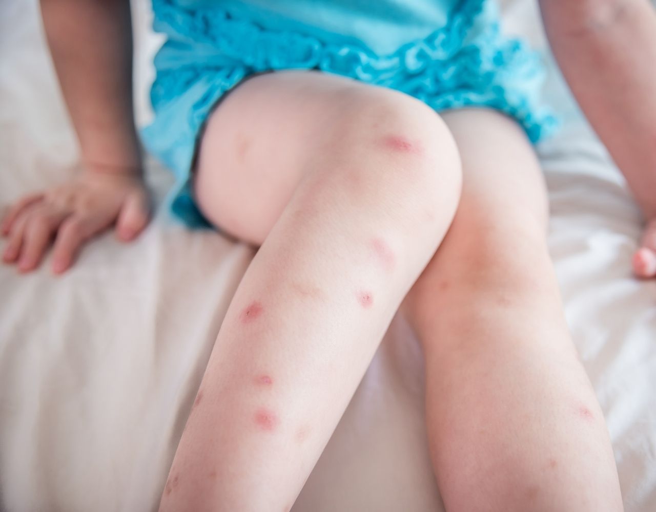 22 Tipps - Der beste Mückenschutz für Kinder und Babys! - 2024